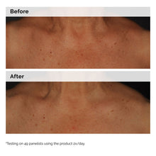 5% Face and Body Emulsion - Smooth Finish