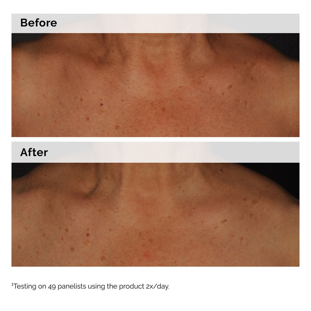 5% Face and Body Emulsion - Simple Support