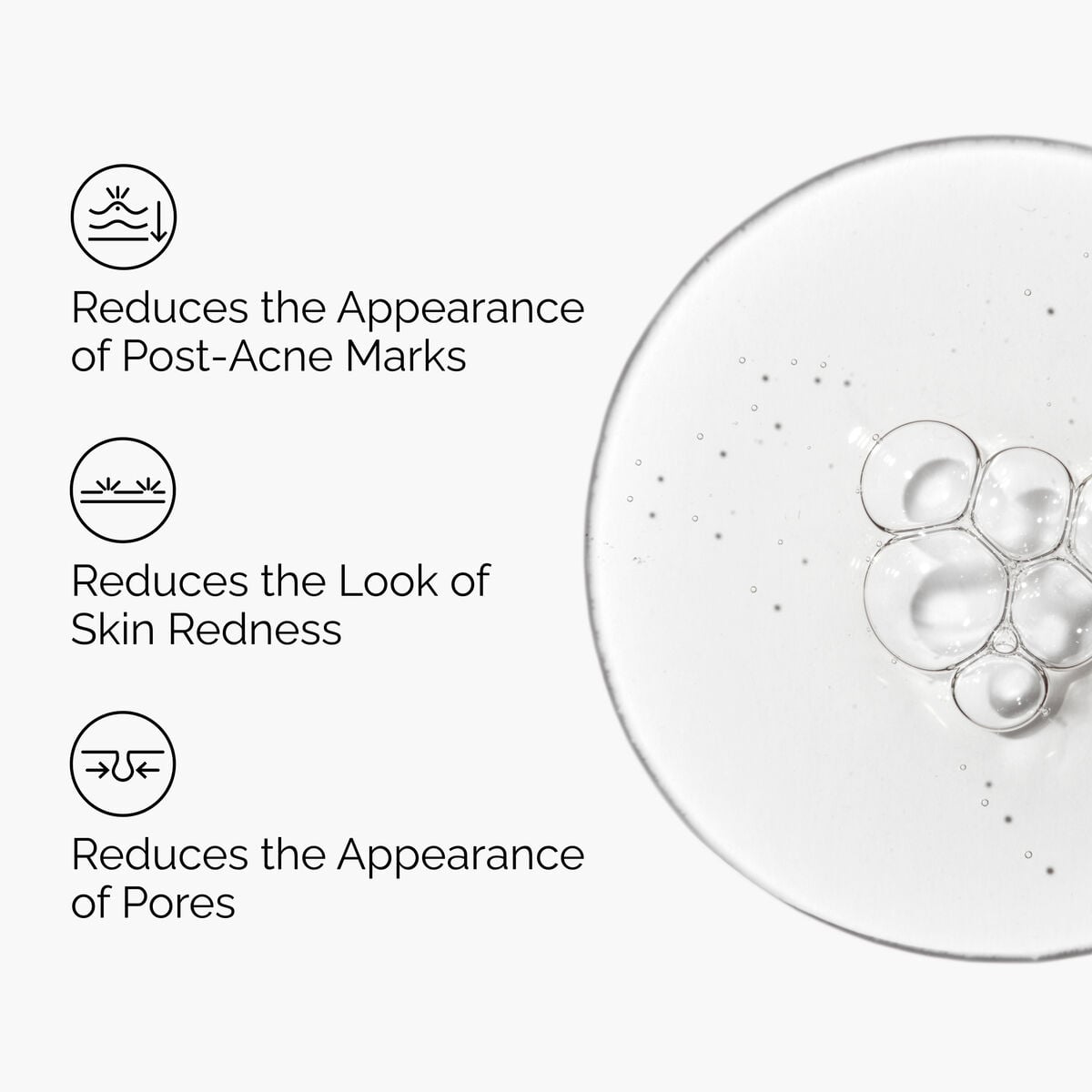 Aloe 2% + NAG 2% Solution - Soft Balance