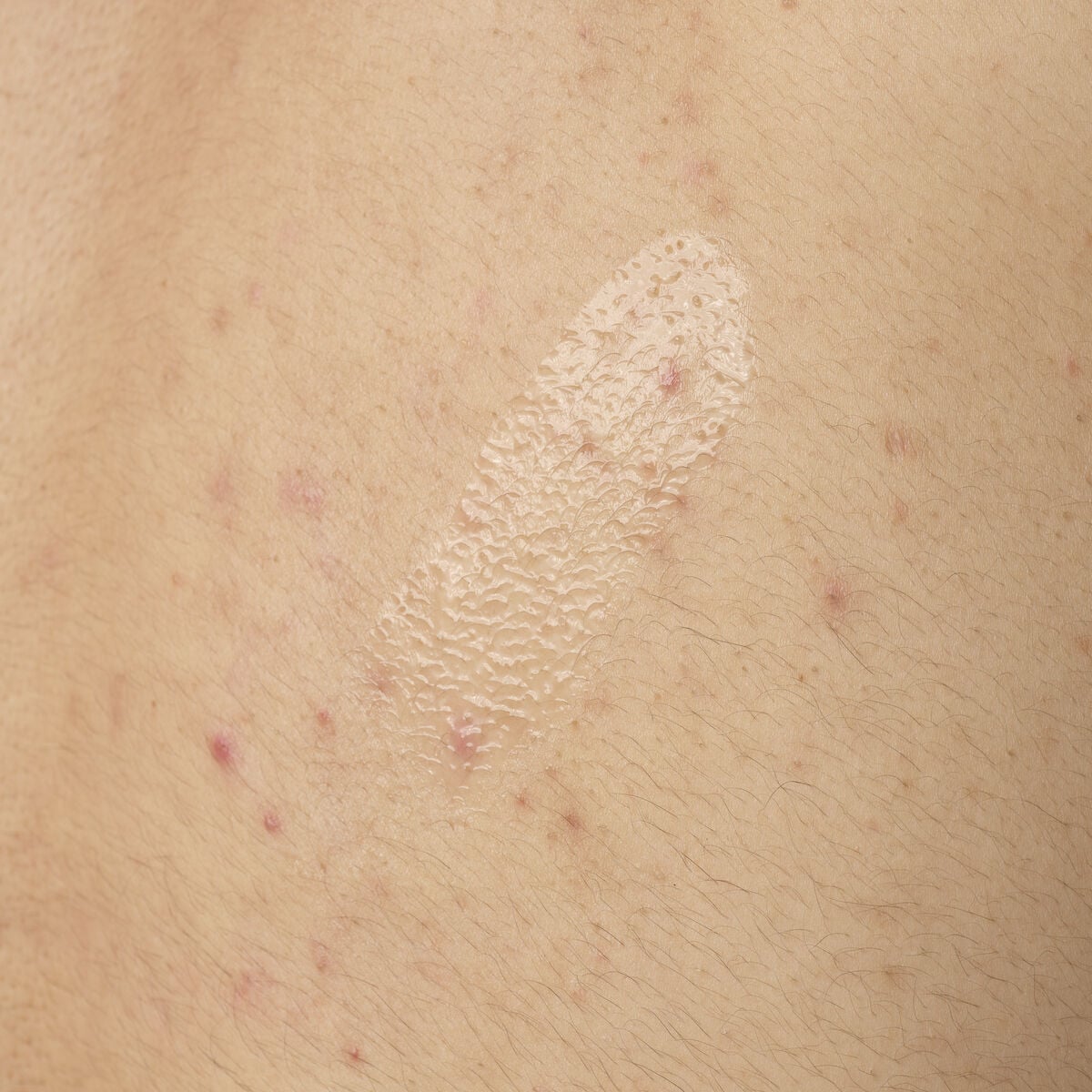 Acid 0.5% Body Serum - Classic Wear