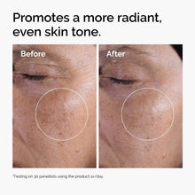Acid 7% Exfoliating Toner - Clean Bundle