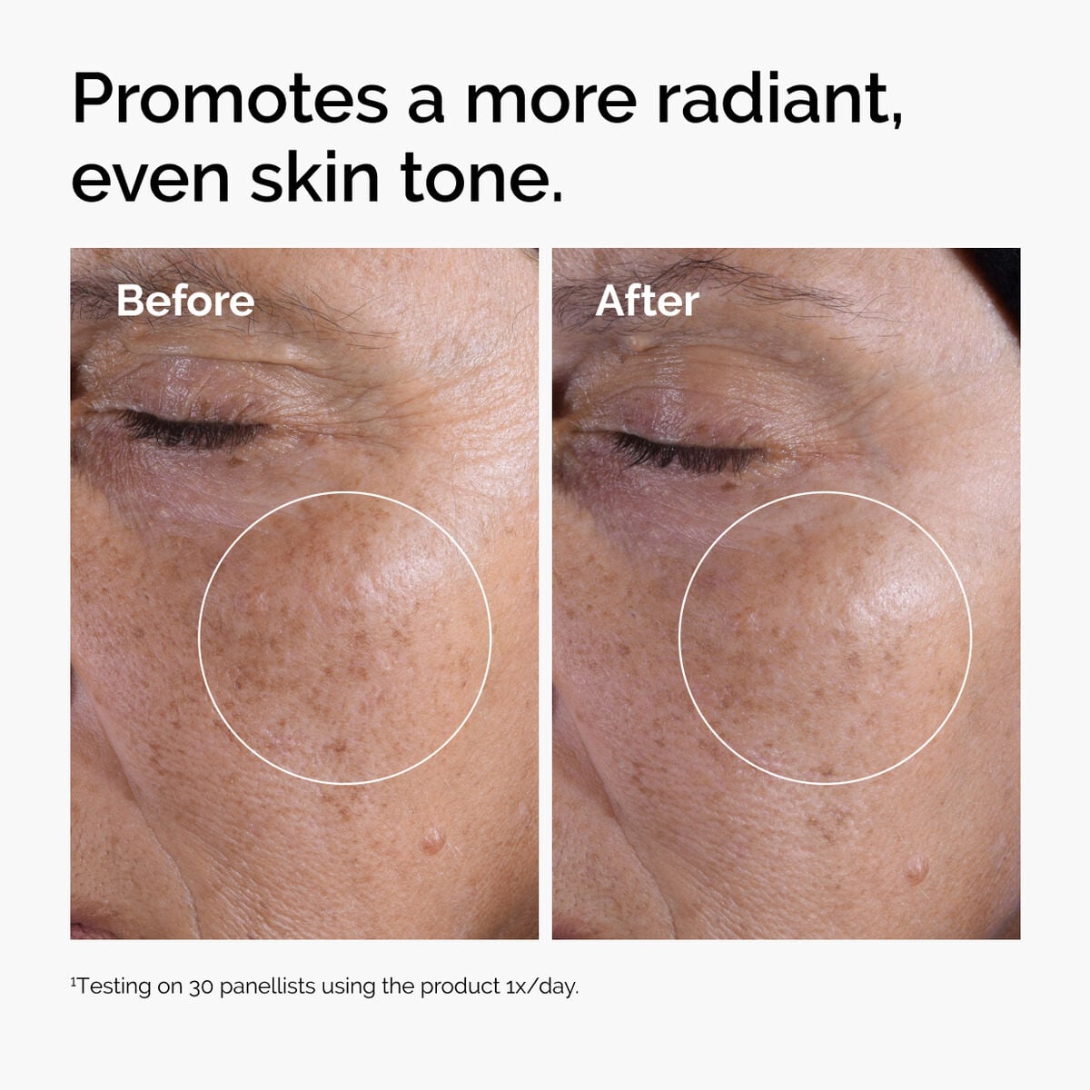 Acid 7% Exfoliating Toner - Clean Bundle