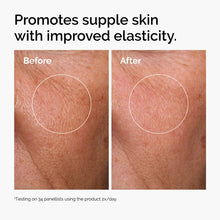 Acid 2% + B5 (with Ceramides) - Soft Glam