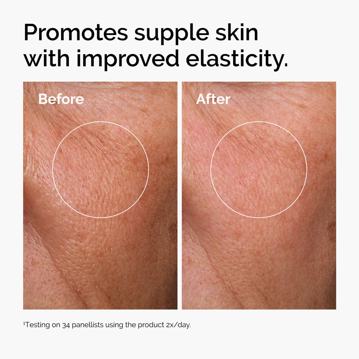 Acid 2% + B5 (with Ceramides) - Soft Glam