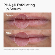 PHA 5% Exfoliating Lip Serum - Daily Glow